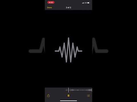 Glizzy glo- pound🥱🙇🏽‍♂️