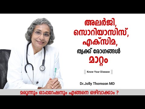 Alergias, psoriasis, eczema: las enfermedades de la piel se pueden revertir [Conozca la enfermeda...