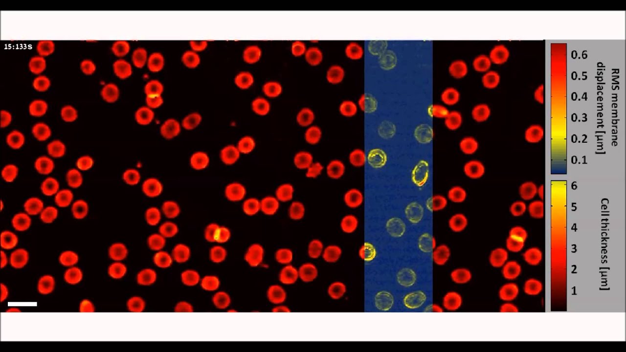 Fast phase processing in off-axis holography using multiplexing with complex encoding...
