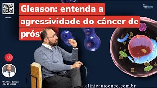 Do PSA à Escala de Gleason: como afetam o diagnóstico e tratamento do Câncer de Próstata