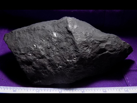 Rimedio per lartrosi del ginocchio MRI del prezzo del ginocchio a Ekaterinburg