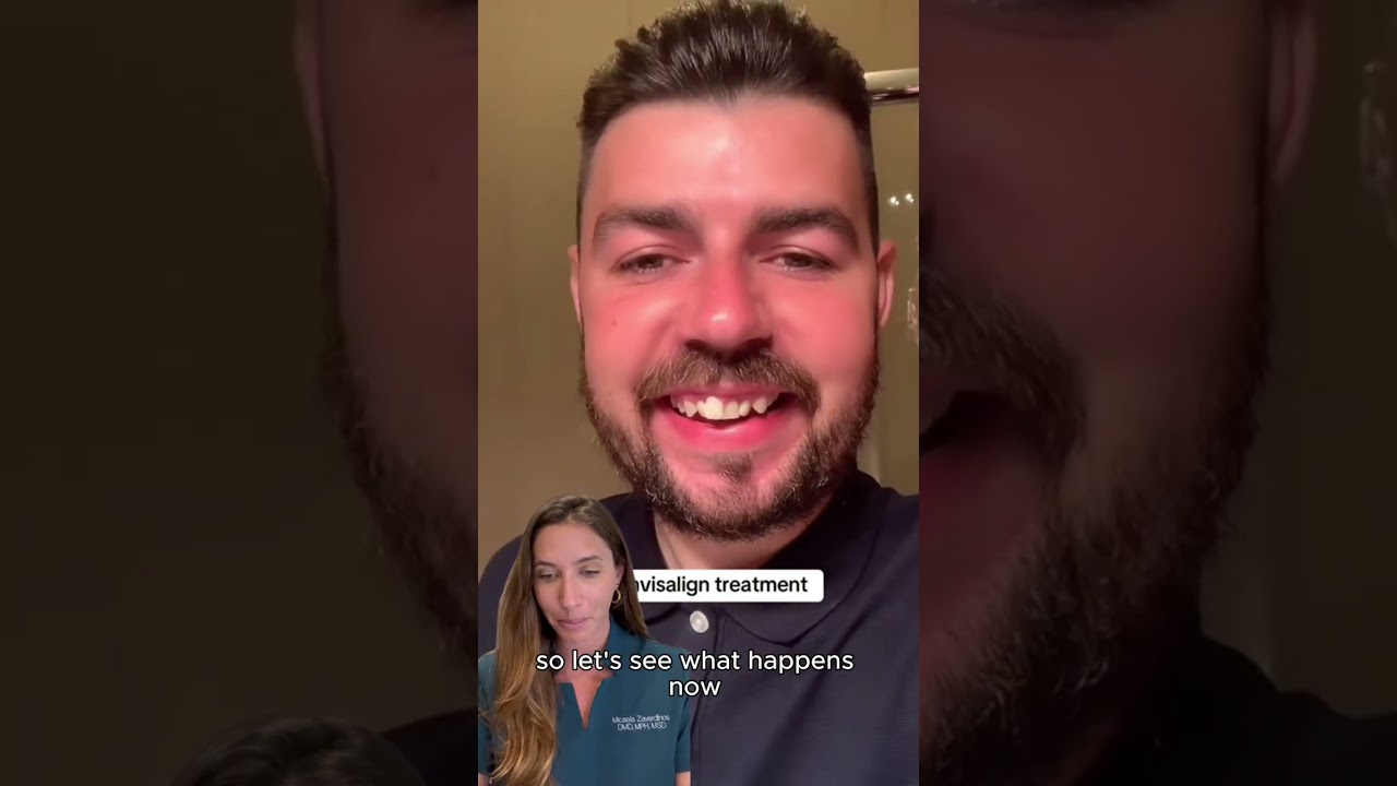 Invisalign Transformation  Clear Smiles Orthodontics Carlsbad