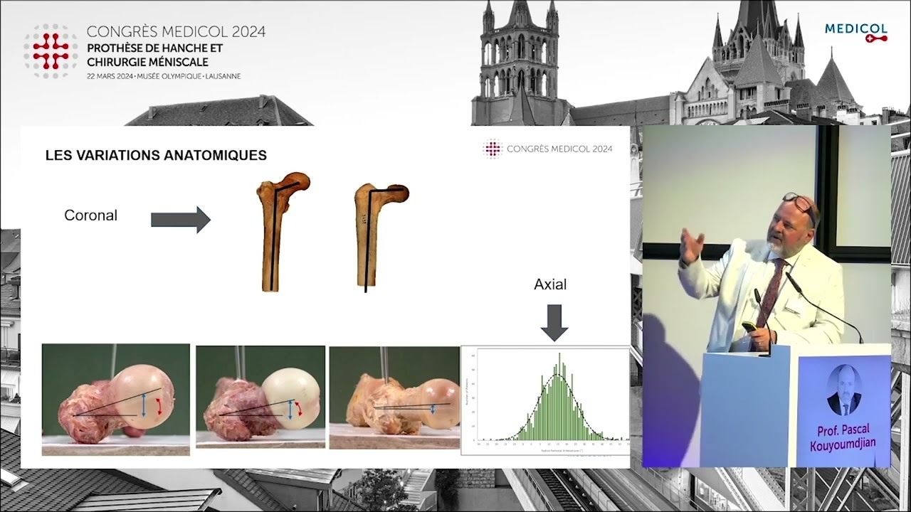 Place de la robotique dans les PTH - Prof. Pascal Kouyoumdjian