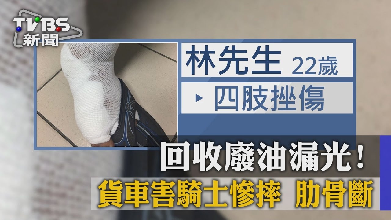 回收廢油漏光!貨車害騎士慘摔 肋骨斷