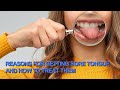Reasons for getting sore tongue and how to treat them