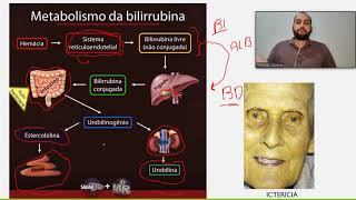 Bioquímica III - Exame químico da urina - urobilinogênio e bilirrubinas