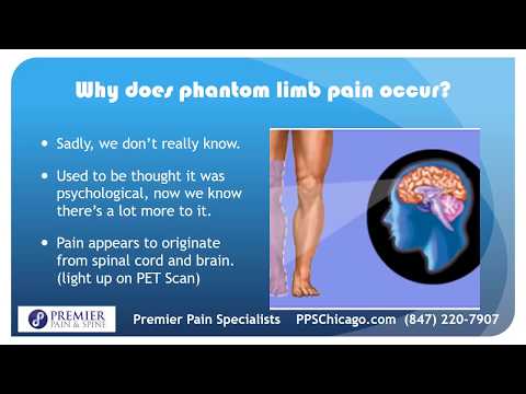 Overview of Phantom Limb Pain Treatment in Chicago (847) 220-7907