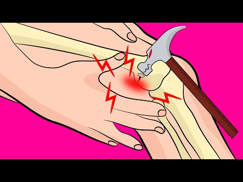 How to Fix IT Band Syndrome Knee Pain FAST!