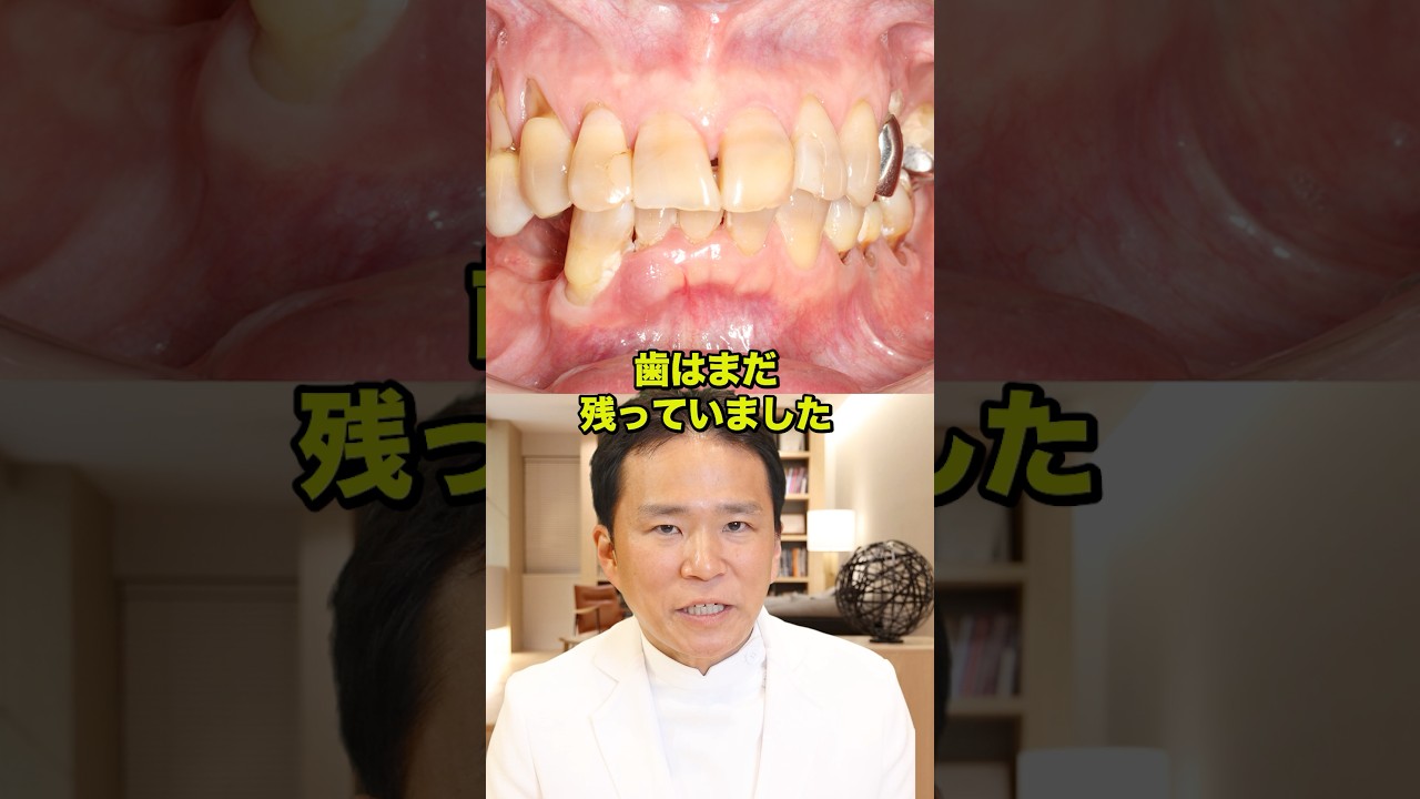 歯は残っている。でも、それだけでした