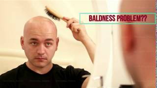 Best Hair Transplant Clinic in Punjab Follicare Hair Solution