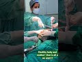 Caesarean Delivery Of A Healthy Baby Baby Babydelivery Doctor