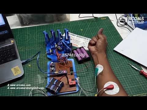 ERRB047 ||  Prosthetic Hand sing EMG Sensor