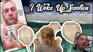 Visiting the Aquarium + Waking up Swollen! by The Baked Clam