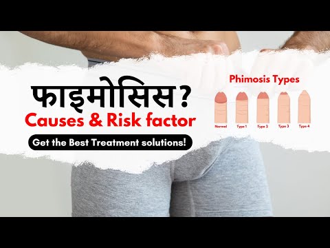 हिंदी में - Types &  Risk Factor of Phimosis | Best Treatment for Phimosis | Surgery or Home Care?