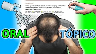 Finasteride TÓPICO Mejor Que ORAL ! Nuevo Estudio comparando 1mg Finasteride Oral.