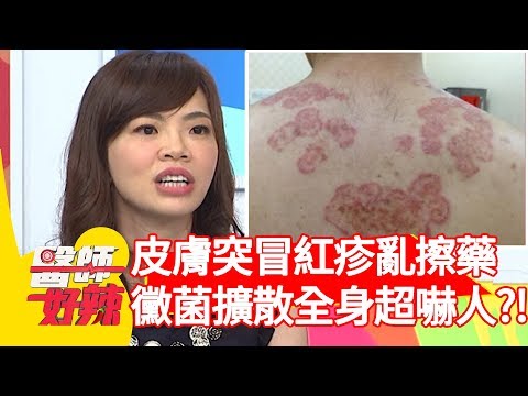 黴菌 種類