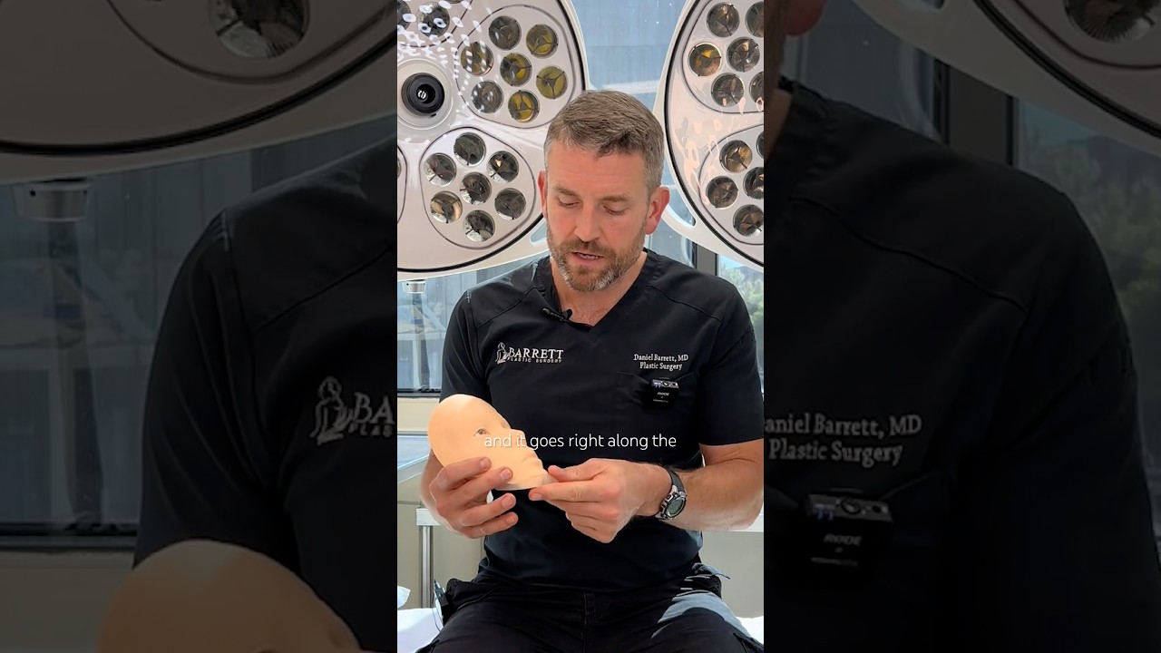 Facial Implants Explained! 🤔
