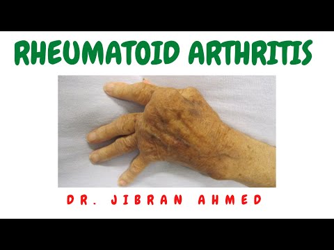 RHEUMATOID ARTHRITIS II BONES AND SOFT TISSUE II ARTHRITIS II ROBBINS 10TH E II PATHOLOGY LECTURES