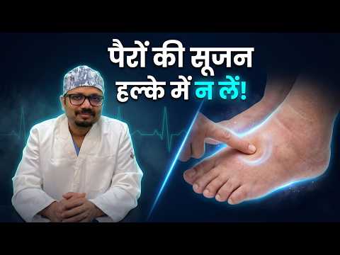 क्या पैरों की सूजन सामान्य है या खतरनाक? 30-सेकंड का होम टेस्ट