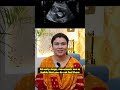 पेट में बच्चा किस दिन से चलने लगता है Baby