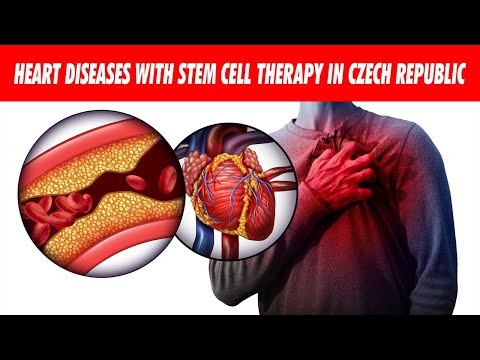 Top Treatment Package for Heart Diseases with Stem Cell Therapy in Czech Republic