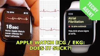The Apple Watch ECG / EKG sensor - Does it suck?