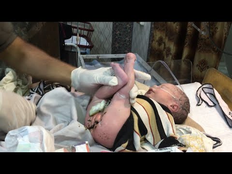 Newborn First 60 Seconds! Critical Assessment That Can Save a Life