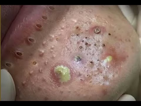 World Sac Dep SPA, 59– Ultimate Relaxation & Massage Therapy