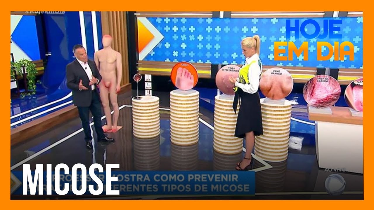 Antonio Sproesser explica como tratar micoses no quadro Você e o Doutor