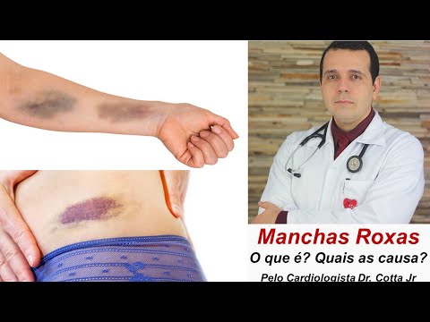 Manchas roxas no corpo: O que são? Quais as causas? Devo me preocupar?
