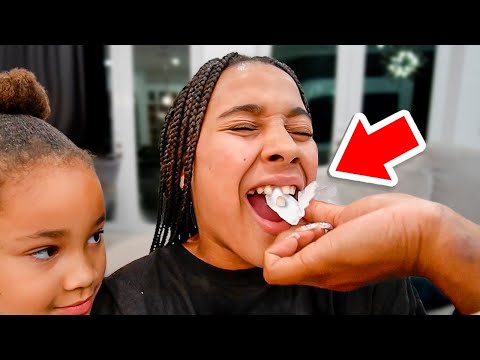 PULLING OUT CALI'S TOOTH ????