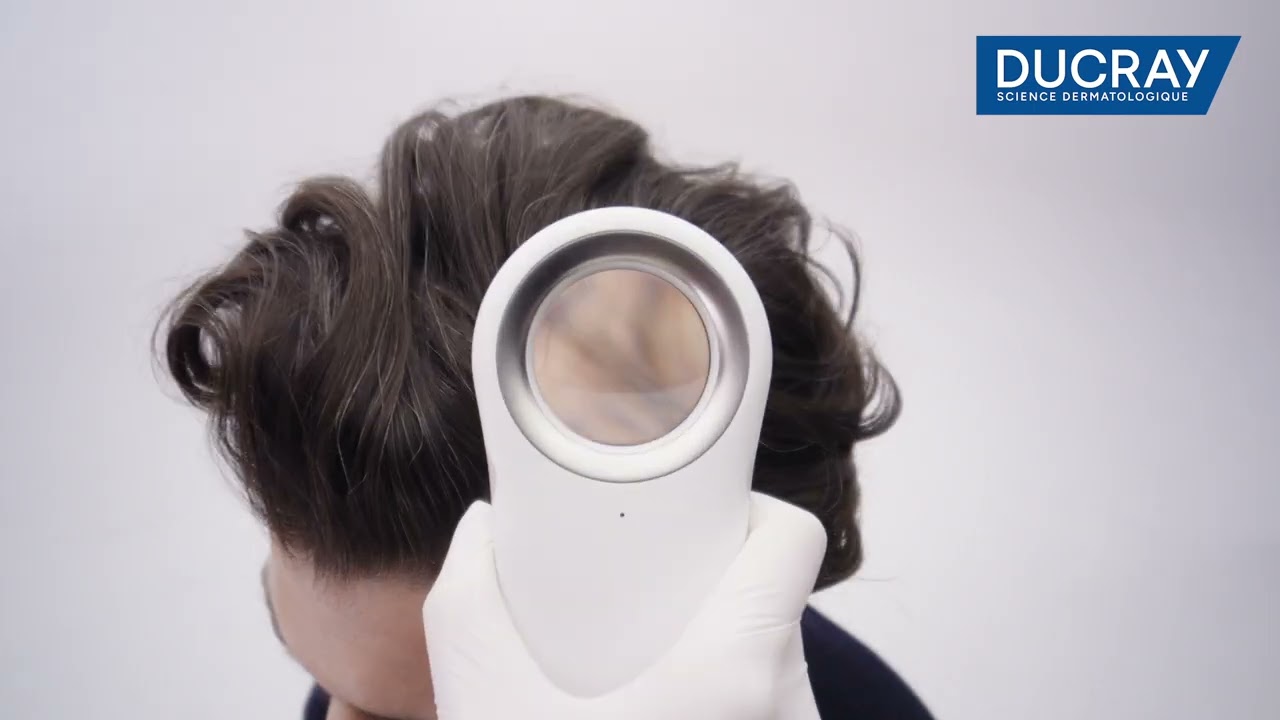 Ducray Kelual DS Intensive Shampooing traitant anti-pelliculaire