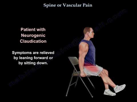 Rückenschmerzen oder Gefäßschmerzen - alles was Sie wissen müssen - Dr. Nabil Ebraheim