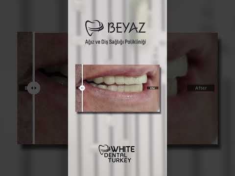 Klinik videolarımızı izleyin