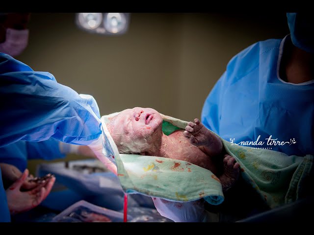 parto-nascimento-newborn-fotografia-foto-fotografa-bebê-berçario-recem-nascido-maternidade-mãe-família-nanda-tirre-cesarea-natural-humanizado-obstetra-pediatra-perinatal-hctco-idealiza-hospital-clinicas-doula-nascer-nasceu-teresopolis-rj-rio de janeiro