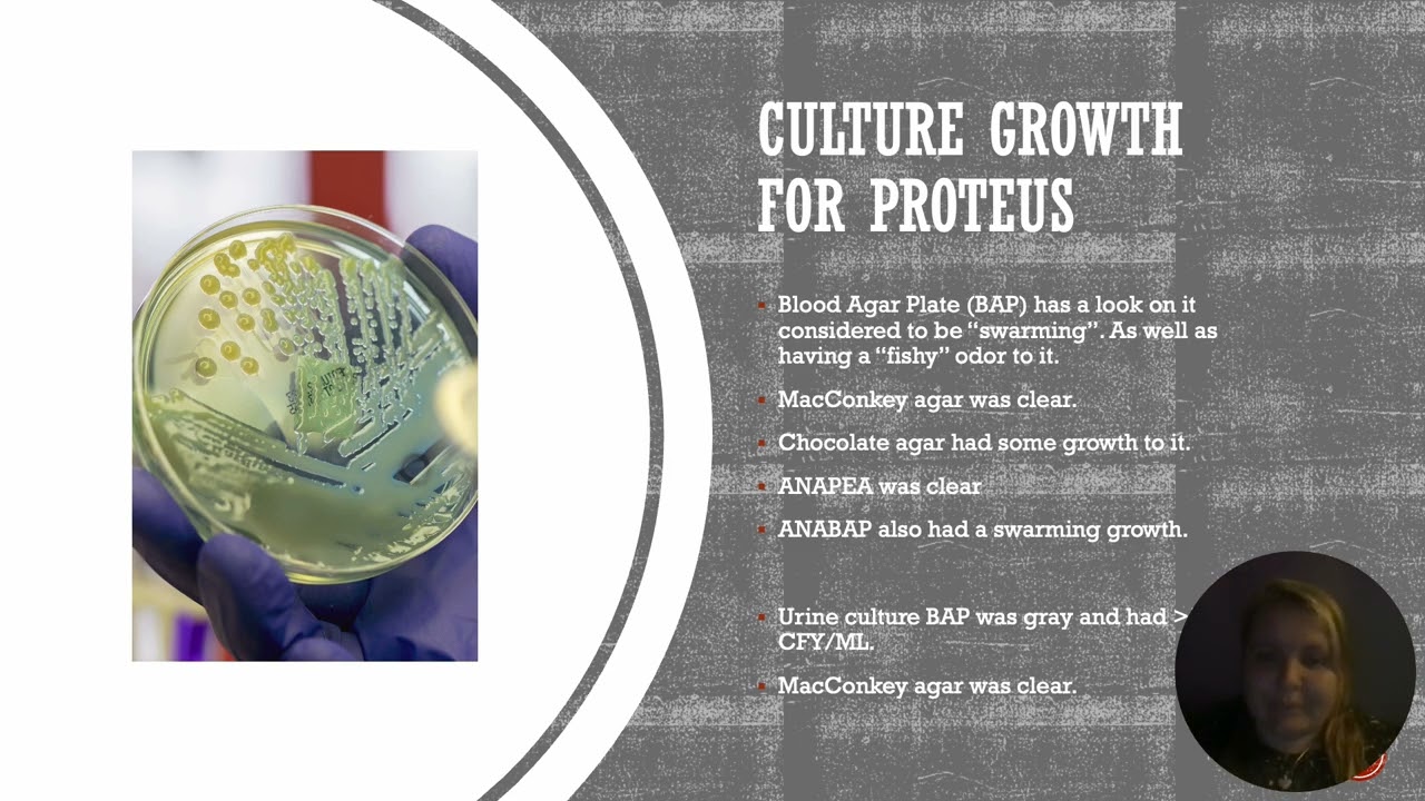 Microbiology case study brandi