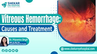 Vitreous Hemorrhage | Symptoms, Causes & Treatments of Vitreous Hemorrhage | Shekar Eye Hospital