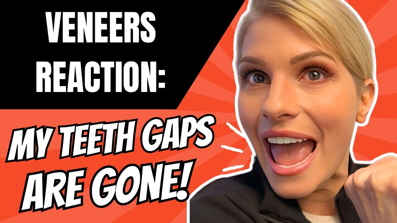 Cosmetic Dentists in Bellevue Seattle WA showing her a new smile makeover with Porcelain Veneers