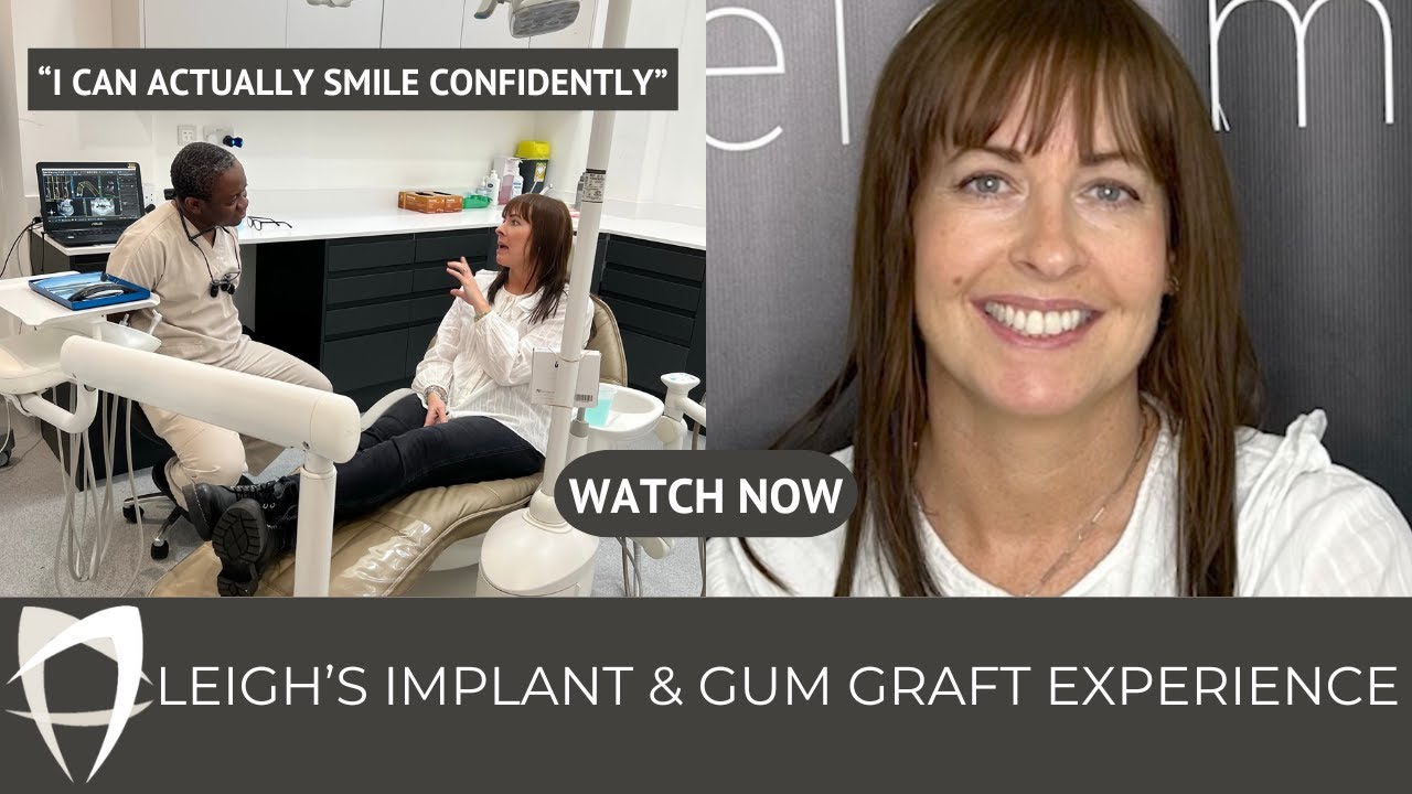 Leigh - Single Implant + Cantilever Bridge with Pink Porcelain