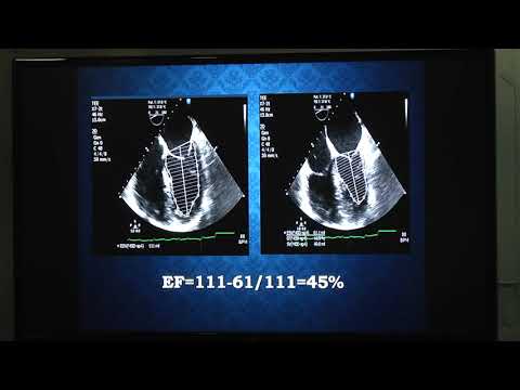 20180822_13_ “How to report TEE?”_ Santosh_Kori_Dr