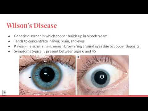 VIBS 243 Group 42: Liver Clinical Correlation