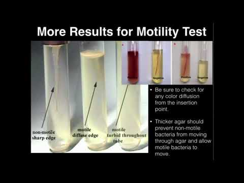 Microbiology: Motility Test