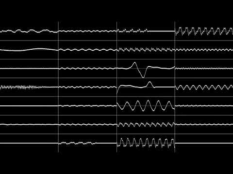 Jeroen Tel - Nine One One (Oscilloscope View)