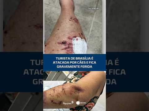 Turista de Brasília é atacada por cães e fica gravemente ferida #CidadeAL