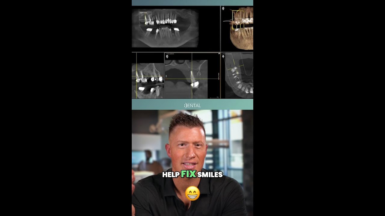 Dental Implants Transform Severe Decay - Tom's Smile Makeover