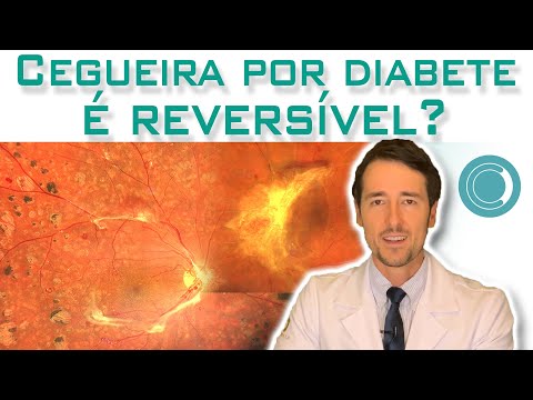 É possível voltar a enxergar após perder a visão por diabete?
