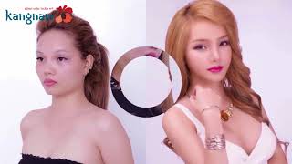 Thẩm mỹ viện Kangnam có TỐT không? Đánh giá từ khách hàng