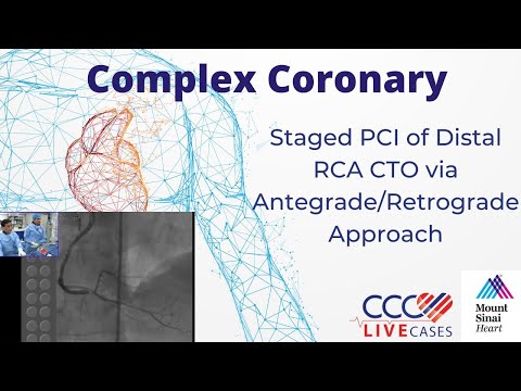 Staged PCI of Distal RCA CTO via Antegrade/Retrograde Approach - September 16, 2014 Webcast