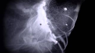 Dyson T-360 Terminator Remix