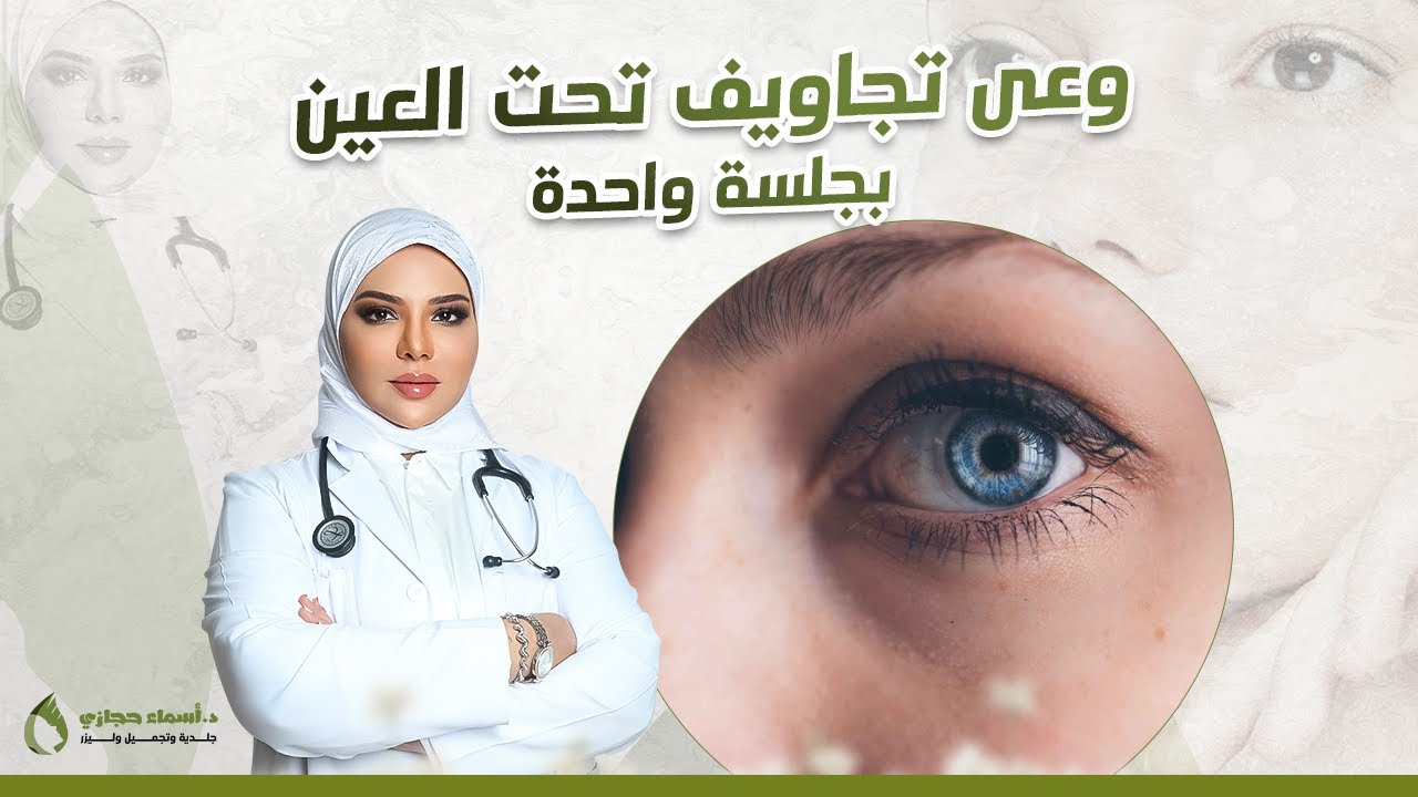 علاج تجويف تحت العين و الهالات السوداء بجلسة واحدة |دكتور اسماء حجازي
